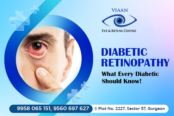 Diabetic Retinopathy: What Every Diabetic Should Know!