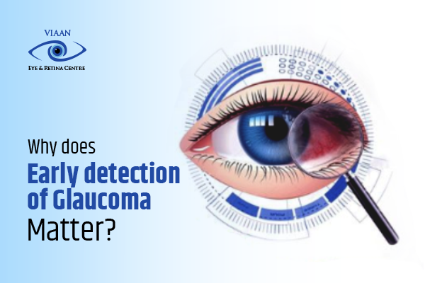Why Does Early Detection And Diagnosis of Glaucoma Matter?