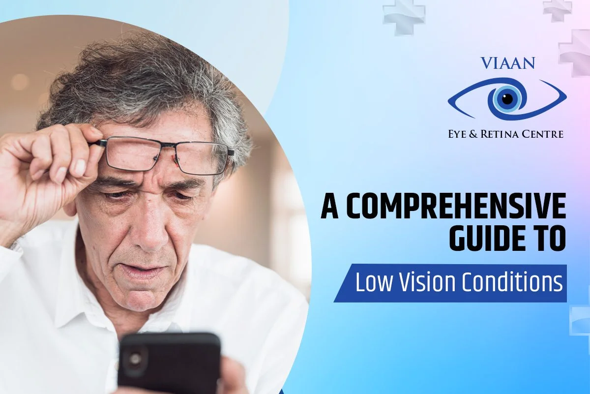 A Comprehensive Guide to Low Vision Conditions- Learn By The Best Eye Hospital In Gurgaon