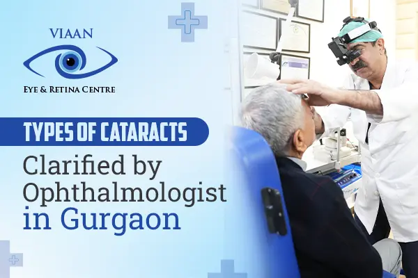 Types of Cataracts Clarified by Ophthalmologist in Gurgaon