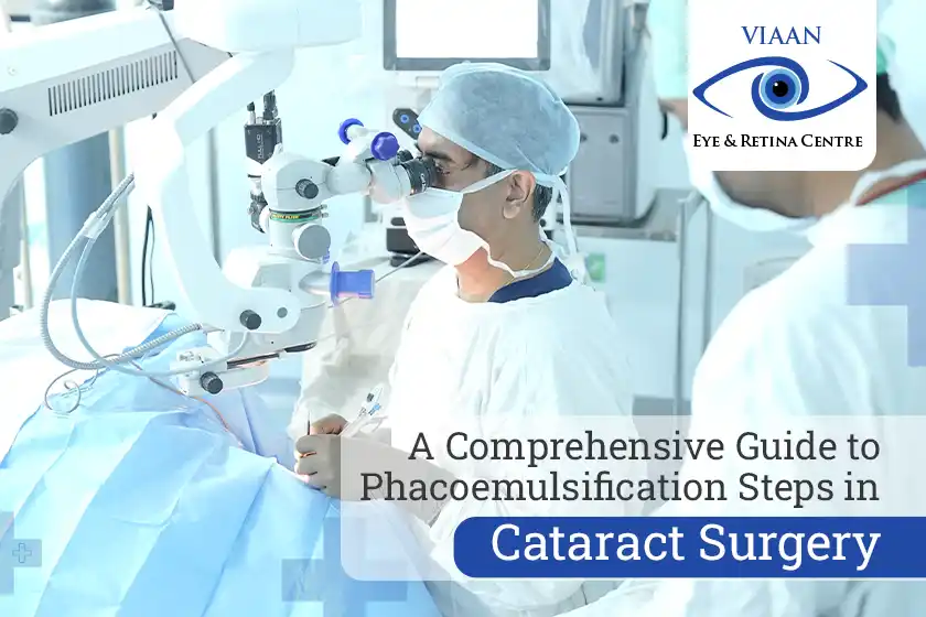 A Comprehensive Guide to Phacoemulsification Steps in Cataract Surgery