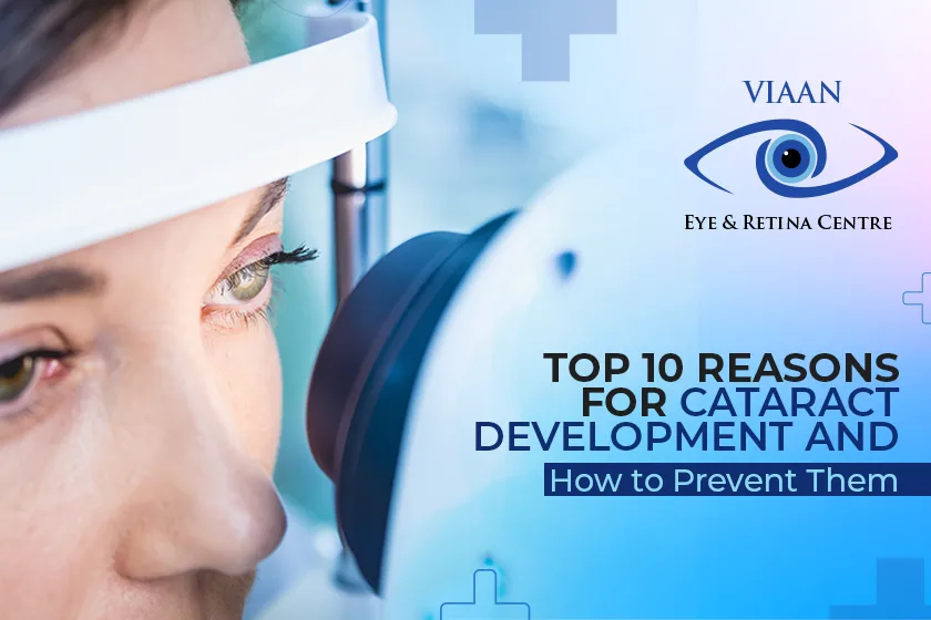 Top 10 Reasons for Cataract Development and How to Prevent Them