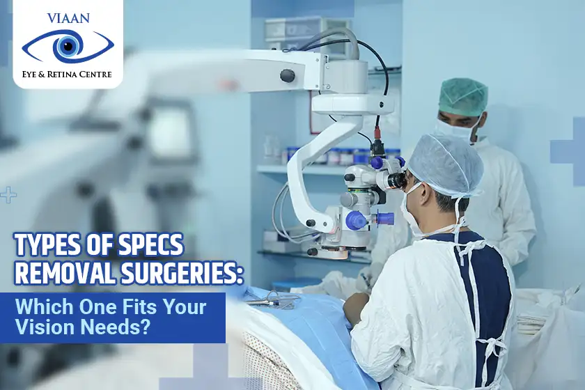 Types of Specs Removal Surgeries: Which One Fits Your Vision Needs?