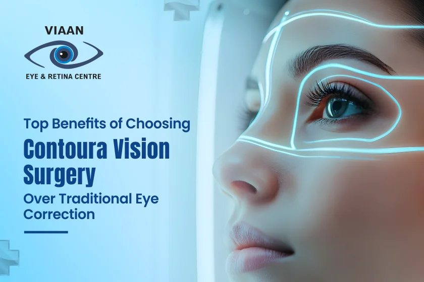 Contoura Vision Surgery