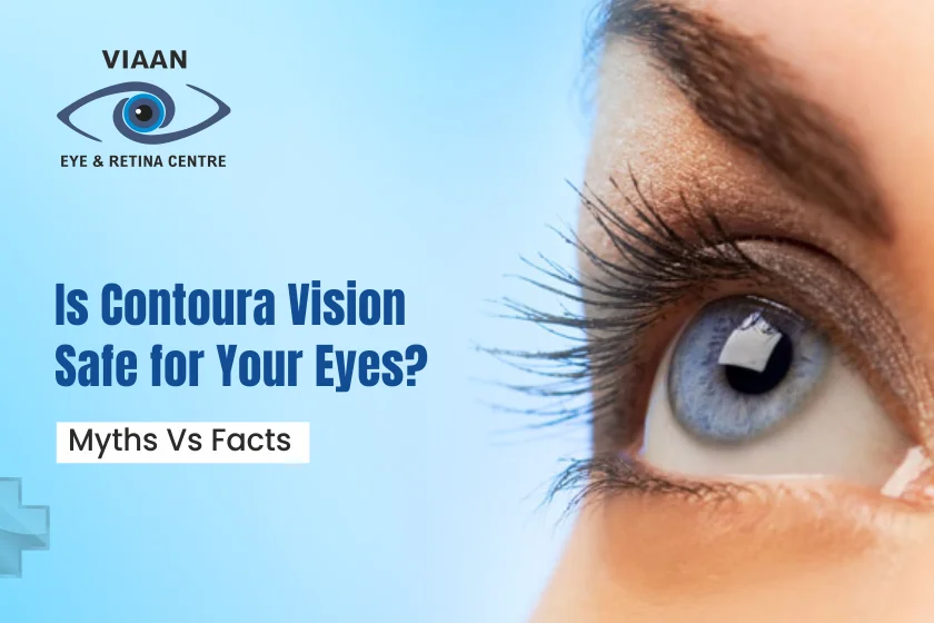 Is Contoura Vision Safe for Your Eyes? Myths vs. Facts