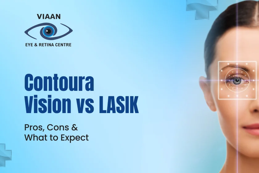 Contoura Vision vs LASIK: Pros, Cons & What to Expect
