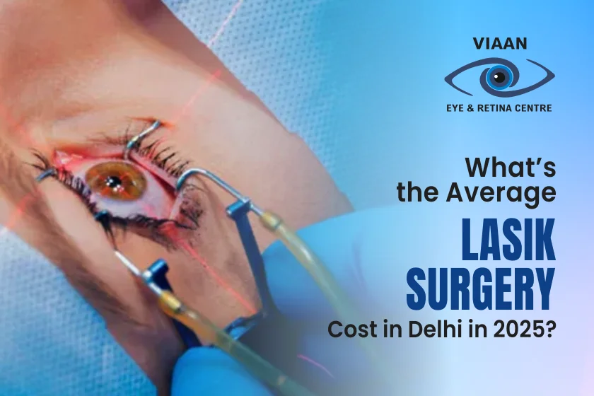 LASIK Surgery Cost in Delhi
