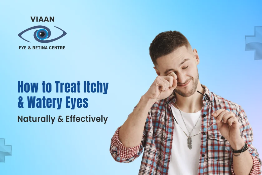 Itchy and Watery Eyes