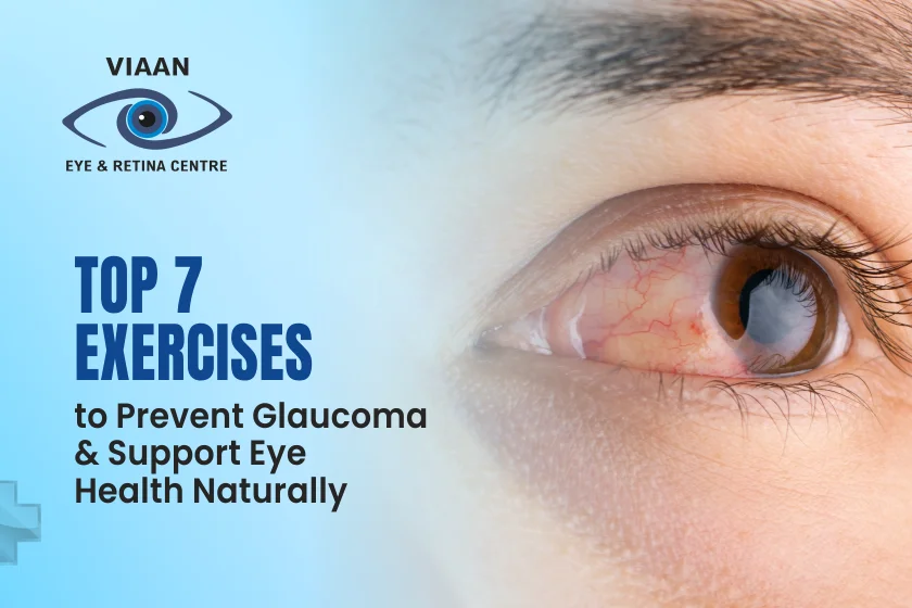 Exercises to Prevent Glaucoma