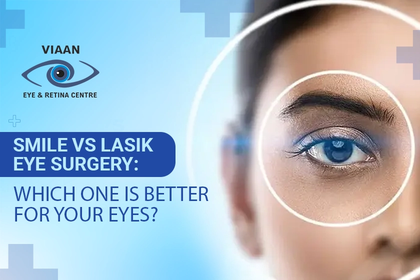 SMILE vs LASIK Eye Surgery