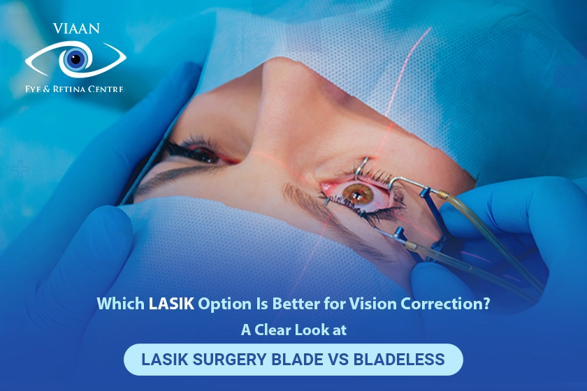 LASIK Surgery Blade Vs Bladeless