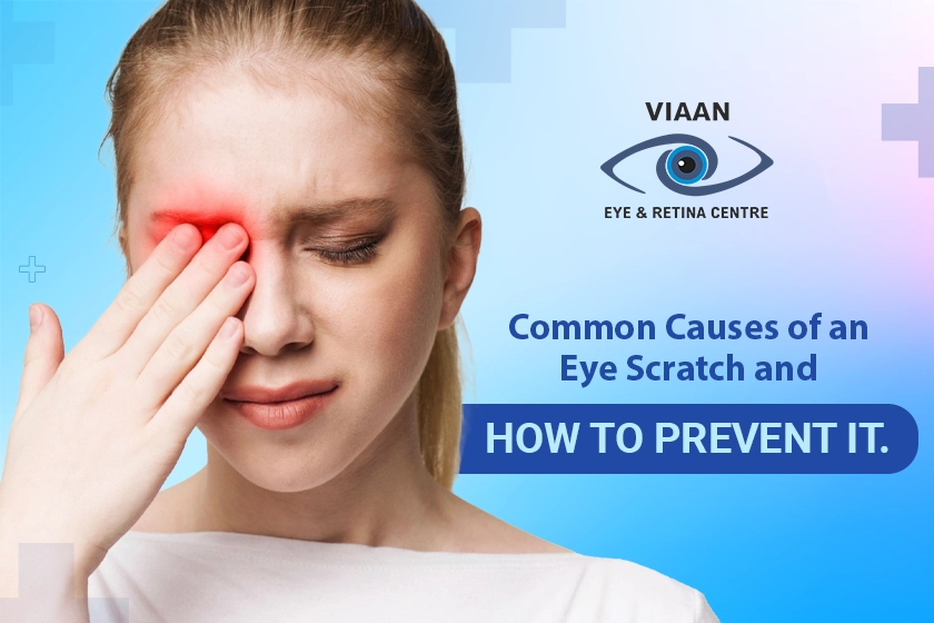 Causes of an Eye Scratch