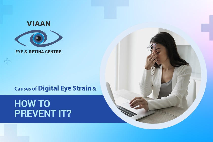 Causes of Digital Eye Strain and How to  Prevent It