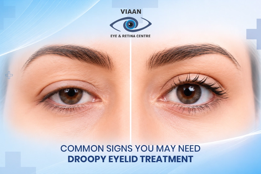 droopy eyelid treatment
