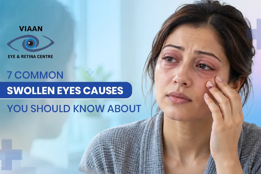 reason of swollen eyes