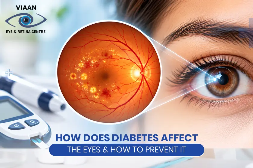 eye problems from diabetes
